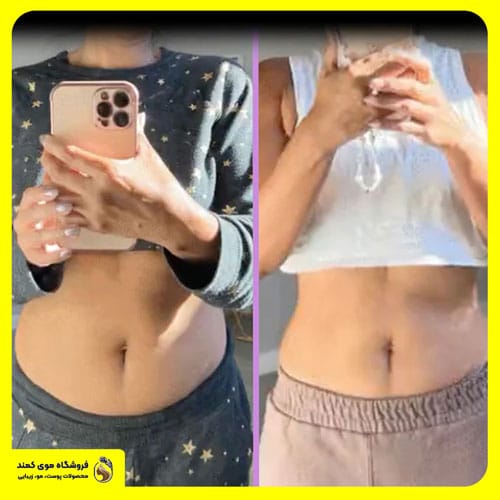 قرص بلوتامین - مکمل لاغری