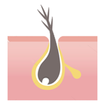 تصویر برای دسته  موی آسیب دیده